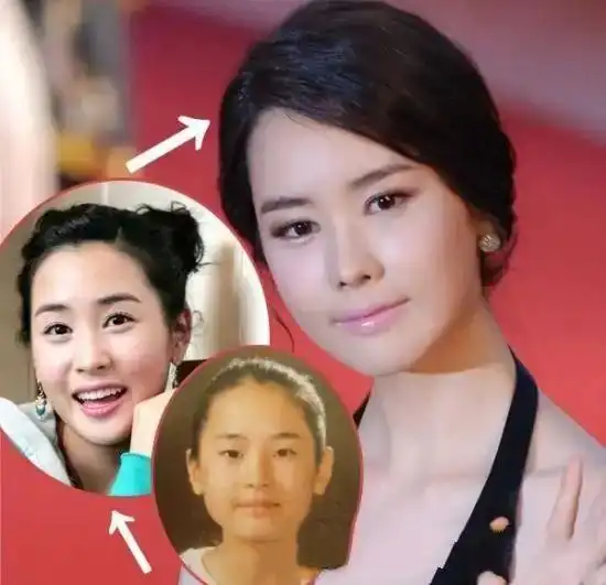 韩国整容文化_韩剧整容女明星_韩剧女主整容前后对比